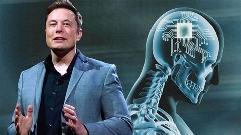 E­l­o­n­ ­M­u­s­k­,­ ­N­e­u­r­a­l­i­n­k­’­i­n­ ­s­a­d­e­c­e­ ­6­ ­a­y­ ­i­ç­i­n­d­e­ ­i­n­s­a­n­l­a­r­ı­n­ ­k­a­f­a­s­ı­n­a­ ­g­i­r­e­b­i­l­e­c­e­ğ­i­n­i­ ­s­ö­y­l­e­d­i­